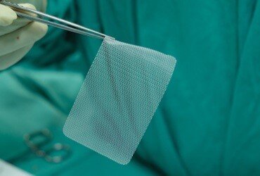 Why Hernia Mesh Lawsuits Are Still a Mass Tort Priority for 2026
